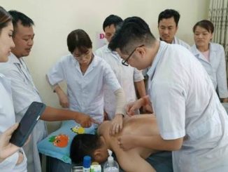Xoa Bóp Bấm Huyệt là gì ?